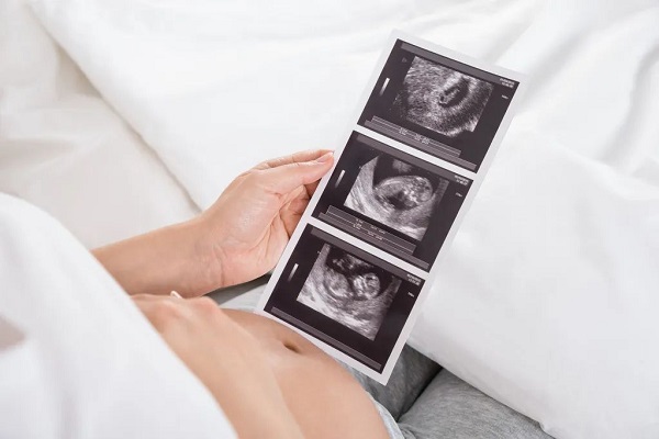 Microplastics can cause damage to the fetal nervous system Microplastics can cause damage to the fetal nervous system